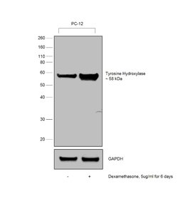 Invitrogen Tyrosine Hydroxylase Monoclonal Antibody (185) 50 &mu;L | Buy Online | Invitrogen&trade; | Fisher Scientific