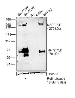 Invitrogen MAP2 Monoclonal Antibody (HM-2) 50 &mu;L; Unconjugated:Antibodies,