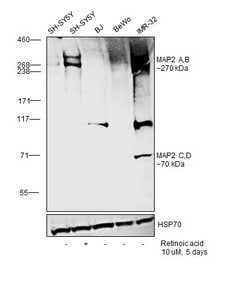 Invitrogen MAP2 Monoclonal Antibody (AP20) 50 &mu;L; Unconjugated:Antibodies,