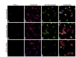Invitrogen TGF beta-1 Monoclonal Antibody (2C5) 250 &mu;g; Unconjugated:Antibodies,