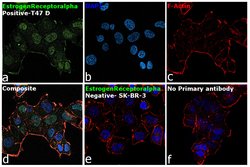 Invitrogen Estrogen Receptor alpha Monoclonal Antibody (6F11) 250 &mu;L;