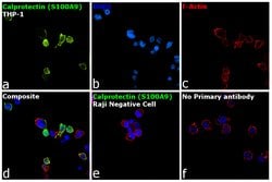 Invitrogen Calprotectin Monoclonal Antibody (MAC387) 100 &mu;g | Buy Online | Invitrogen&trade; | Fisher Scientific