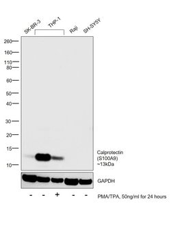 Invitrogen Calprotectin Monoclonal Antibody (MAC387) 100 &mu;g | Buy Online | Invitrogen&trade; | Fisher Scientific