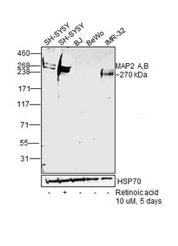 Invitrogen MAP2 Monoclonal Antibody (MT-01) 100 &mu;g; Unconjugated:Antibodies,