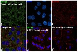 Invitrogen Cytokeratin 18 Monoclonal Antibody (M9) 1 mL; Unconjugated:Antibodies,