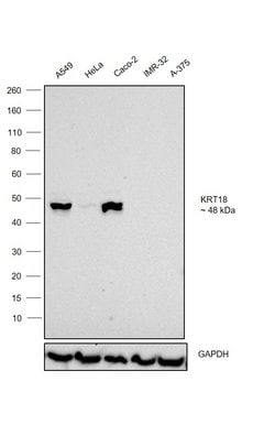 Invitrogen Cytokeratin 18 Monoclonal Antibody (M9) 1 mL; Unconjugated:Antibodies,