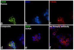 Invitrogen CD20 Monoclonal Antibody (SP32) 500 &mu;L; Unconjugated:Antibodies,