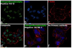 Invitrogen Estrogen Receptor alpha Monoclonal Antibody (SP1) 1 mL; Unconjugated:Antibodies,