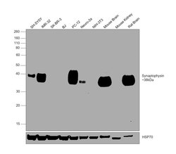 Invitrogen Synaptophysin Monoclonal Antibody (SP11):Antibodies:Primary