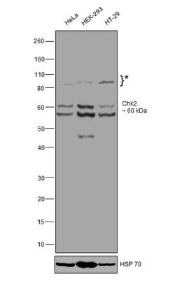 Invitrogen CHK2 Monoclonal Antibody (73C175.1.1) 100 &mu;g; Unconjugated:Antibodies,