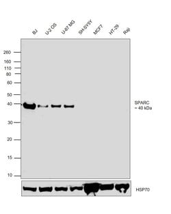 Invitrogen SPARC Monoclonal Antibody (5031) 100 μg; Unconjugated:Antibodies,