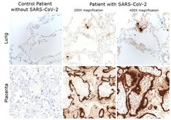 Invitrogen SARS/SARS-CoV-2 Nucleocapsid Monoclonal Antibody (E16C) 100