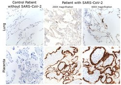 Invitrogen SARS/SARS-CoV-2 Nucleocapsid Monoclonal Antibody (B46F) 100