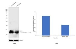 Invitrogen PSEN2 Monoclonal Antibody (APS 21) 200 &mu;g; Unconjugated:Antibodies,