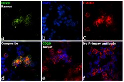 Invitrogen CD20 Monoclonal Antibody (B9E9) 100 &mu;g; Unconjugated:Antibodies,