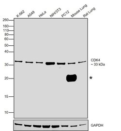 Invitrogen CDK4 Monoclonal Antibody (DCS-31.2) 100 &mu;g; Unconjugated:Antibodies,