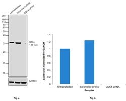 Invitrogen CDK4 Monoclonal Antibody (DCS-31.2) 100 &mu;g; Unconjugated:Antibodies,