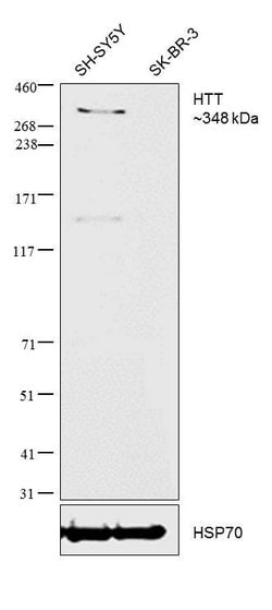 Invitrogen Huntingtin Monoclonal Antibody (HDC8A4) 100 &mu;g; Unconjugated:Antibodies,