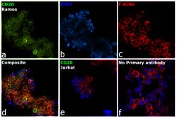 Invitrogen CD20 Monoclonal Antibody (2H7) 200 &mu;g; Unconjugated:Antibodies,