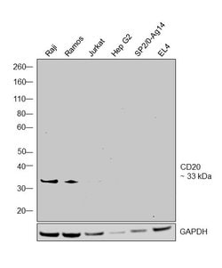 Invitrogen CD20 Monoclonal Antibody (2H7) 200 &mu;g; Unconjugated:Antibodies,