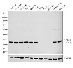 Invitrogen PGP9.5 Monoclonal Antibody (31A3) 200 &mu;g; Unconjugated:Antibodies,