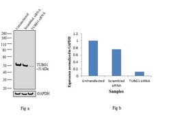 Invitrogen gamma Tubulin Monoclonal Antibody (4D11) 100 &mu;g; Unconjugated:Antibodies,