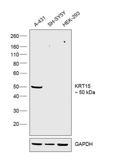 Invitrogen Cytokeratin 15 Monoclonal Antibody (LHK15) 500 &mu;L; Unconjugated:Antibodies,