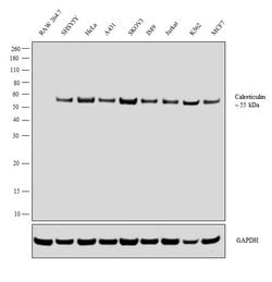 Invitrogen Calreticulin Monoclonal Antibody (FMC 75) 100 &mu;g | Buy Online | Invitrogen&trade; | Fisher Scientific