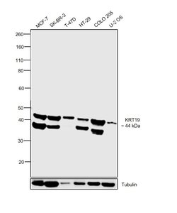 Invitrogen Cytokeratin 19 Monoclonal Antibody (BA16) 100 &mu;g; Unconjugated:Antibodies,