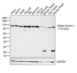 Invitrogen alpha Actinin 1 Monoclonal Antibody (0.T.02) 100 &mu;g | Buy Online | Invitrogen&trade; | Fisher Scientific