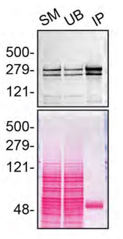 Invitrogen Huntingtin Monoclonal Antibody (1HU-4C8) 50 &mu;L; Unconjugated:Antibodies,