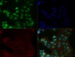 Invitrogen MGMT Monoclonal Antibody (MT 23.2) 100 &mu;L | Buy Online | Invitrogen&trade; | Fisher Scientific