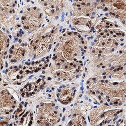 Invitrogen MGMT Monoclonal Antibody (MT 23.2) 100 &mu;L | Buy Online | Invitrogen&trade; | Fisher Scientific
