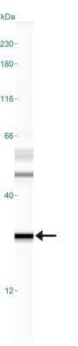 Invitrogen MGMT Monoclonal Antibody (MT 23.2) 100 &mu;L | Buy Online | Invitrogen&trade; | Fisher Scientific