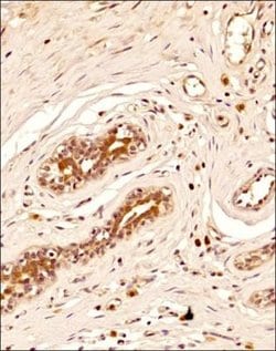 Invitrogen BRIP1 Monoclonal Antibody (pp15-IB4) 100 &mu;L; Unconjugated:Antibodies,