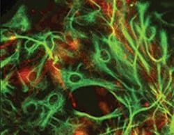 Invitrogen alpha Internexin Monoclonal Antibody (2E3) 100 &mu;L; Unconjugated:Antibodies,