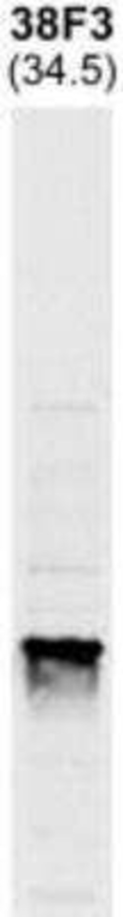 Invitrogen Fibrillarin Monoclonal Antibody (38F3) 250 &mu;L; Unconjugated:Anticuerpos