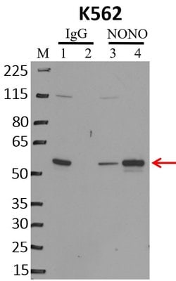 Invitrogen NONO Monoclonal Antibody (78-1 C) 100 &mu;L; Unconjugated:Antibodies,