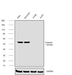 Invitrogen Vimentin Monoclonal Antibody (J144) 200 &mu;L; Unconjugated:Anticorps,