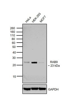 Invitrogen RAB9 Monoclonal Antibody (Mab9) 100 &mu;L | Buy Online | Invitrogen&trade; | Fisher Scientific