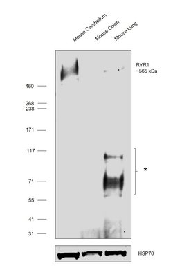 Invitrogen Ryanodine Receptor Monoclonal Antibody (C3-33) 100 &mu;g; Unconjugated:Antibodies,