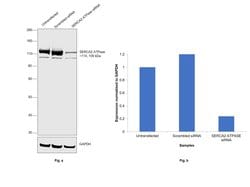 Invitrogen SERCA2 ATPase Monoclonal Antibody (2A7-A1) 100 &mu;L; Unconjugated:Antibodies