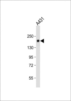 Invitrogen PRDM10 Monoclonal Antibody (48AT1224.90.46) 400 &mu;L; Unconjugated:Antibodies,