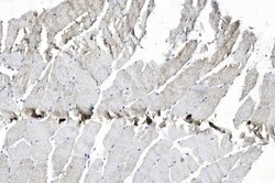 Invitrogen EphB2 Monoclonal Antibody (48CT12.6.4) 200 &mu;L; Unconjugated:Antibodies,