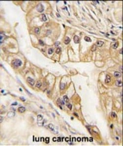 Invitrogen EphB2 Monoclonal Antibody (48CT12.6.4) 200 &mu;L; Unconjugated:Antibodies,