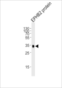 Invitrogen EphB2 Monoclonal Antibody (48CT12.6.4) 200 &mu;L; Unconjugated:Antibodies,