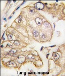 Invitrogen VEGF Receptor 3 Monoclonal Antibody (44CT92.4.4) 400 &mu;L;