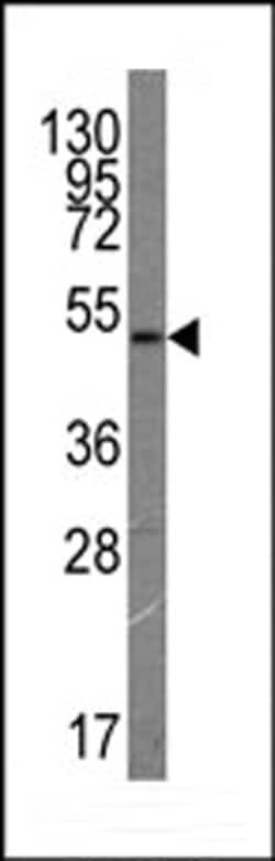 Invitrogen VEGF Receptor 3 Monoclonal Antibody (44CT92.4.4) 400 &mu;L;