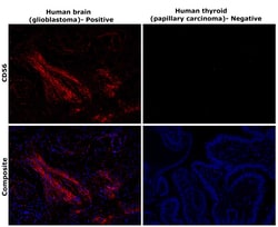 Invitrogen CD56 Monoclonal Antibody (56C04) 500 &mu;L | Buy Online | Invitrogen&trade; | Fisher Scientific