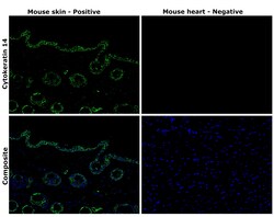 Invitrogen Cytokeratin 14 Monoclonal Antibody (LL002) 500 &mu;L; Unconjugated:Antibodies,